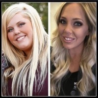 Przed i po utracie wagi...